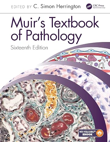 Muir's Textbook of Pathology: Sixteenth Edition International Student Edition